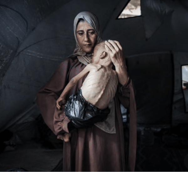 Starving Gazans